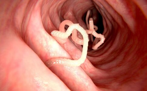 червеи в човешкото тяло