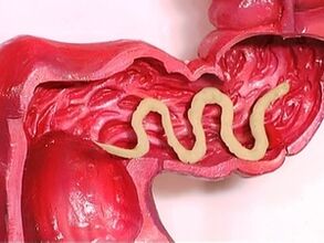 паразити в човешкото тяло, защо се появяват