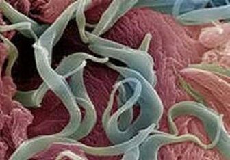 Симптоми и лечение на паразити в човешкото тяло