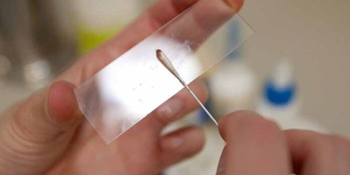 Изстъргване на кожата за паразити