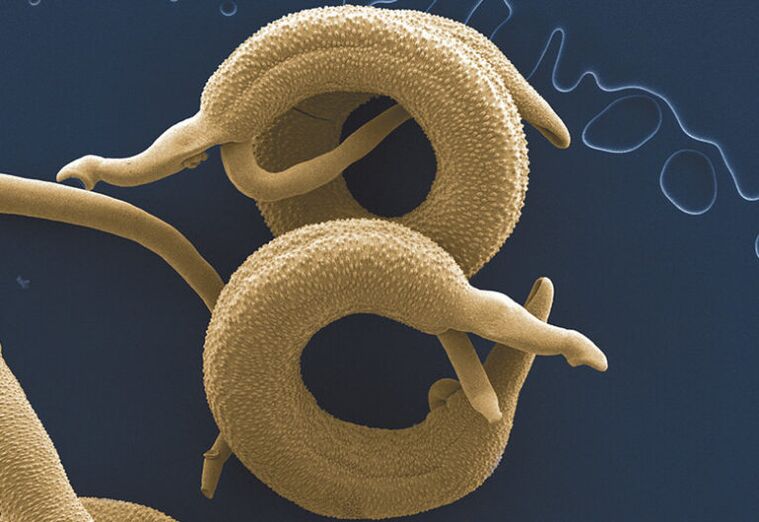 паразити, живеещи в човешкото тяло